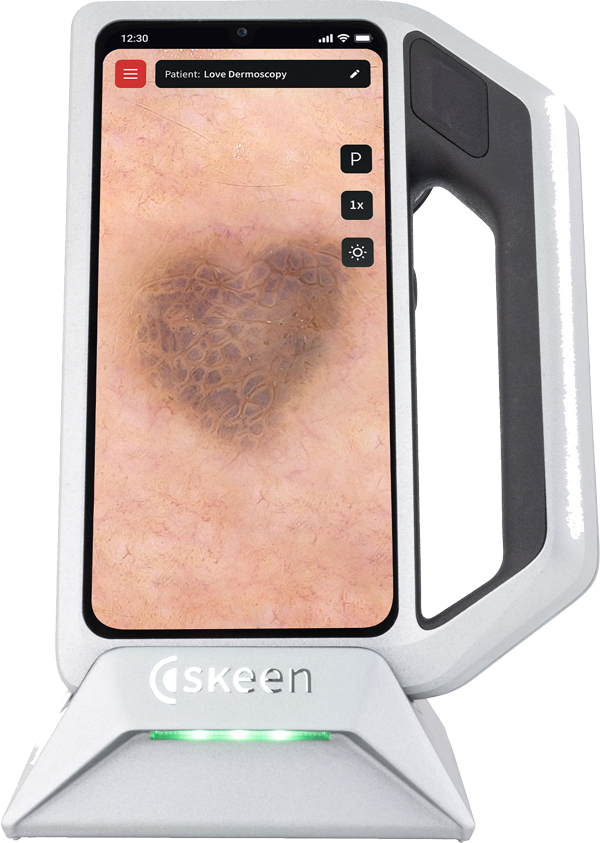 Skin cancer screening and clinical skin examination